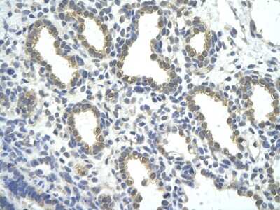 Immunohistochemistry-Paraffin: ZNF274 Antibody [NBP3-10523]