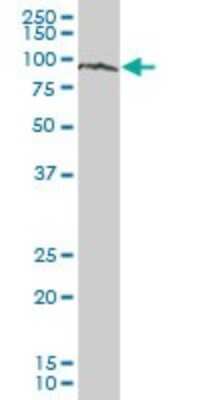 Western Blot: ZNF274 Antibody [H00010782-B01P]