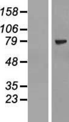 Western Blot: ZNF274 Overexpression Lysate [NBL1-18107]