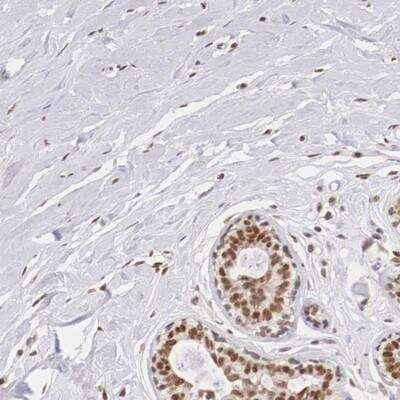 Immunohistochemistry-Paraffin: ZNF275 Antibody [NBP1-91205]