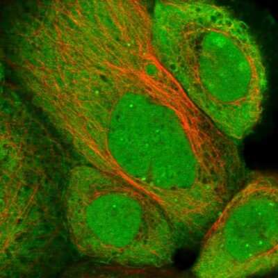 Immunocytochemistry/ Immunofluorescence: ZNF276 Antibody [NBP1-82681]