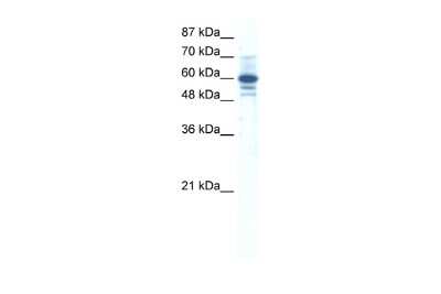 Western Blot: ZNF276 Antibody [NBP2-88658]