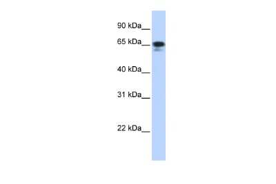 Western Blot: ZNF276 Antibody [NBP2-88660]