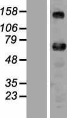 Western Blot: ZNF276 Overexpression Lysate [NBP2-05409]