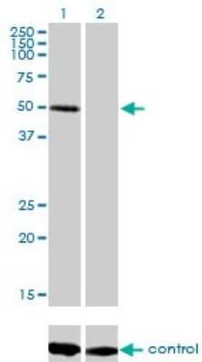 Western Blot: ZNF277 Antibody (1B2) [H00011179-M01]