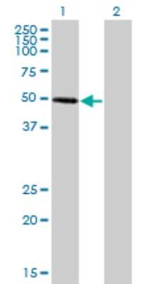 Western Blot: ZNF277 Antibody (1B2) [H00011179-M01]