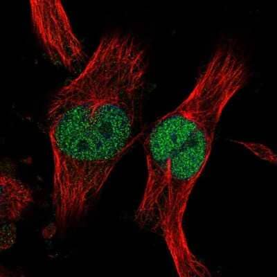 Immunocytochemistry/ Immunofluorescence: ZNF277 Antibody [NBP1-82529]