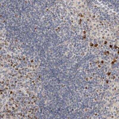 Immunohistochemistry-Paraffin: ZNF277 Antibody [NBP1-82529]