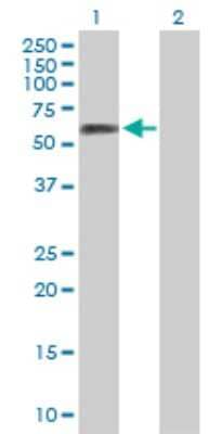 Western Blot: ZNF277 Antibody [H00011179-B01P]