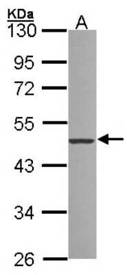 Western Blot: ZNF277 Antibody [NBP1-32228]