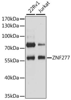 Western Blot: ZNF277 AntibodyAzide and BSA Free [NBP2-93373]