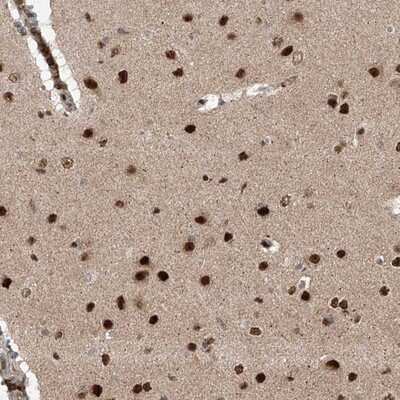 Immunohistochemistry-Paraffin: ZNF280D Antibody [NBP1-82207]