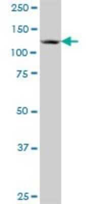 Western Blot: ZNF280D Antibody [H00054816-B01P]