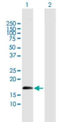 Western Blot: ZNF280D Antibody [H00054816-B01P]