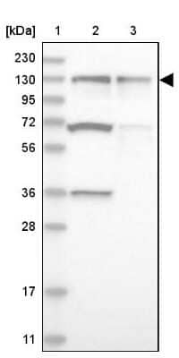 Western Blot: ZNF280D Antibody [NBP1-82207]