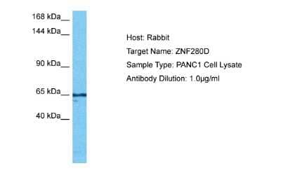 Western Blot: ZNF280D Antibody [NBP2-86468]