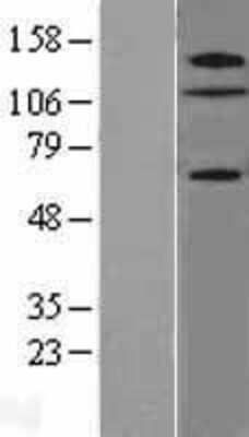 Western Blot: ZNF280D Overexpression Lysate [NBL1-18110]