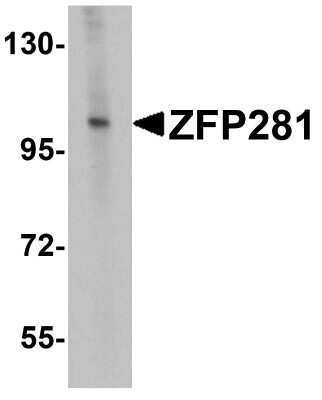 Western Blot: ZNF281 AntibodyBSA Free [NBP1-76551]