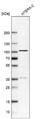 Western Blot: ZNF281 Antibody [NBP2-13564]