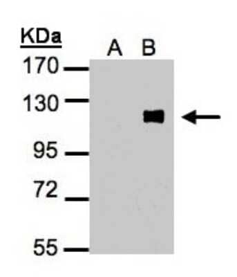 Western Blot: ZNF281 Antibody [NBP2-20984]