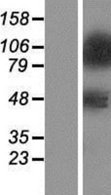 Western Blot: ZNF281 Overexpression Lysate [NBP2-07434]