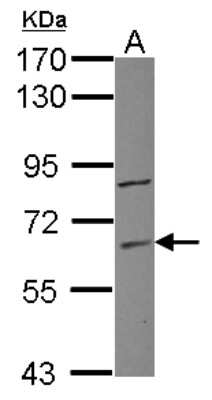 Western Blot: ZNF282 Antibody [NBP2-20985]