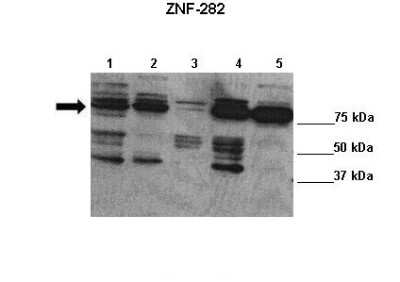 Western Blot: ZNF282 Antibody [NBP2-86470]