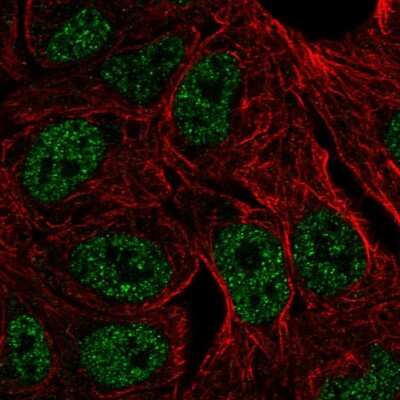 Immunocytochemistry/ Immunofluorescence: ZNF283 Antibody [NBP2-57438]