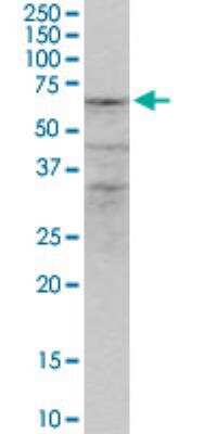 Western Blot: ZNF284 Antibody [H00342909-B01P-50ug]