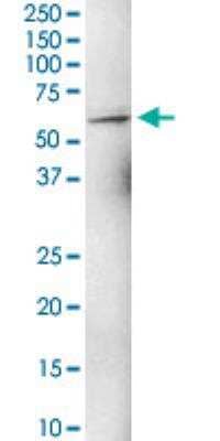 Western Blot: ZNF284 Antibody [H00342909-B01P-50ug]