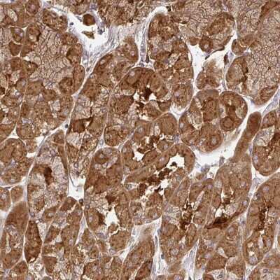 Immunohistochemistry: ZNF285A Antibody [NBP2-33554]