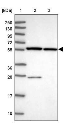 Western Blot: ZNF285A Antibody [NBP2-33454]