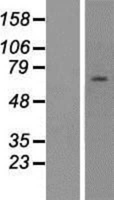 Western Blot: ZNF285A Overexpression Lysate [NBP2-05393]