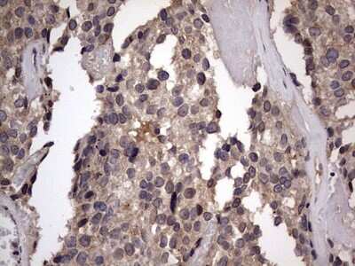 Immunohistochemistry: ZNF286 Antibody (OTI7D2) [NBP2-46432]
