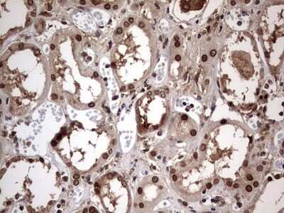 Immunohistochemistry: ZNF286 Antibody (OTI7D2) [NBP2-46432]