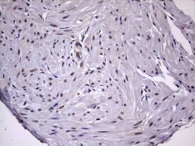 Immunohistochemistry: ZNF286 Antibody (OTI7D2) [NBP2-46432]