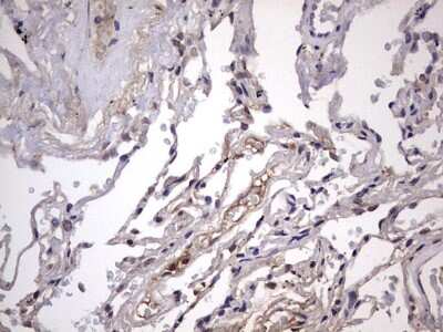 Immunohistochemistry: ZNF286 Antibody (OTI7D2) [NBP2-46432]