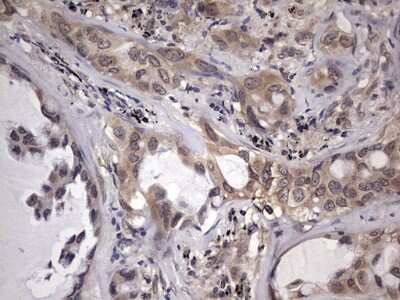 Immunohistochemistry: ZNF286 Antibody (OTI7D2) [NBP2-46432]