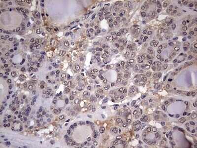 Immunohistochemistry: ZNF286 Antibody (OTI7D2) [NBP2-46432]