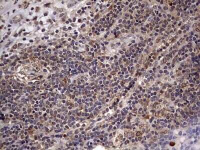 Immunohistochemistry: ZNF286 Antibody (OTI7D2) [NBP2-46432]