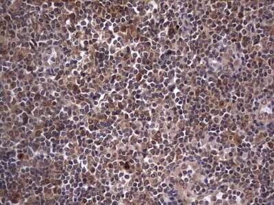 Immunohistochemistry: ZNF286 Antibody (OTI7D2) [NBP2-46432]