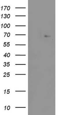 Western Blot: ZNF286 Antibody (OTI7D2) [NBP2-46432]