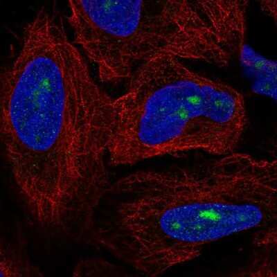 Immunocytochemistry/ Immunofluorescence: ZNF286 Antibody [NBP2-58226]