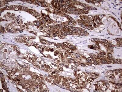 Immunohistochemistry: ZNF286 Antibody (OTI7D2) - Azide and BSA Free [NBP2-74935]