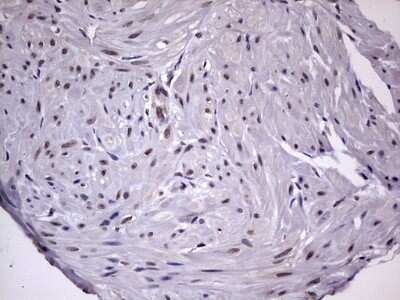 Immunohistochemistry: ZNF286 Antibody (OTI7D2) - Azide and BSA Free [NBP2-74935]