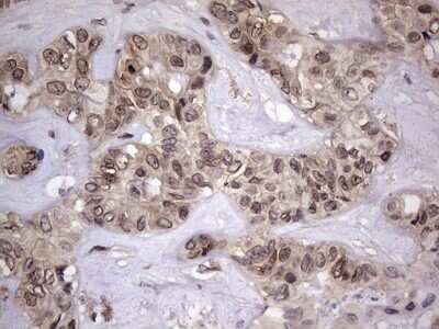 Immunohistochemistry: ZNF286 Antibody (OTI7D2) - Azide and BSA Free [NBP2-74935]