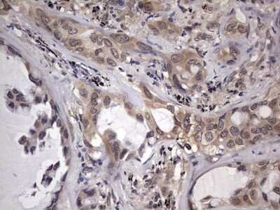 Immunohistochemistry: ZNF286 Antibody (OTI7D2) - Azide and BSA Free [NBP2-74935]