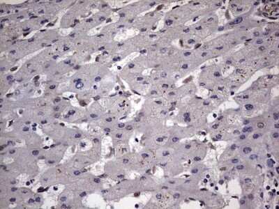 Immunohistochemistry: ZNF286 Antibody (OTI7D2) - Azide and BSA Free [NBP2-74935]