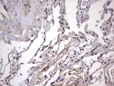 Immunohistochemistry: ZNF286 Antibody (OTI7D2) - Azide and BSA Free [NBP2-74935]