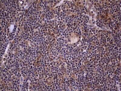 Immunohistochemistry: ZNF286 Antibody (OTI7D2) - Azide and BSA Free [NBP2-74935]